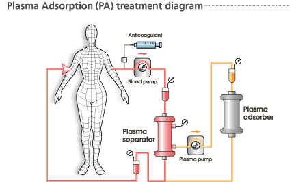 Plasma Adsorption (PA) treatment diagram
