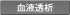 血液透析