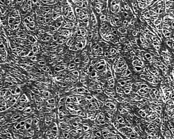 Micrograph of small pore diameter HIPORE™