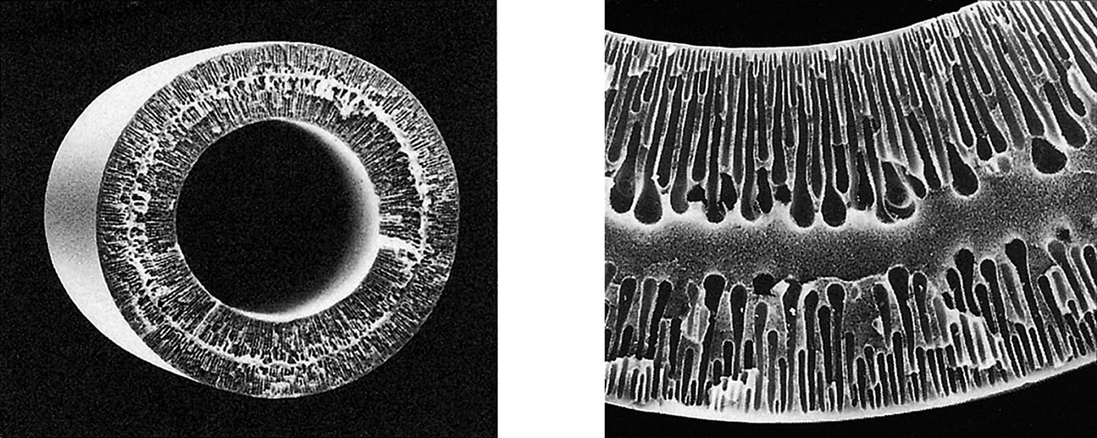 Electron Micrograph of Microza® Industrial Process UF AP/SP Series