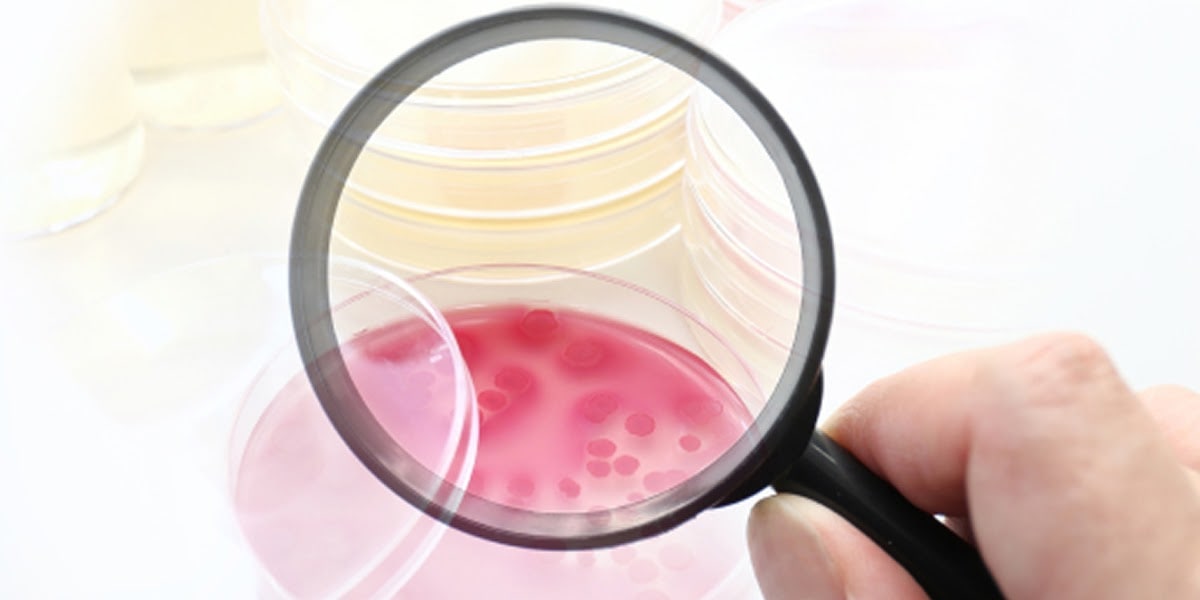 Improved Downstream Productivity in Enzyme Production