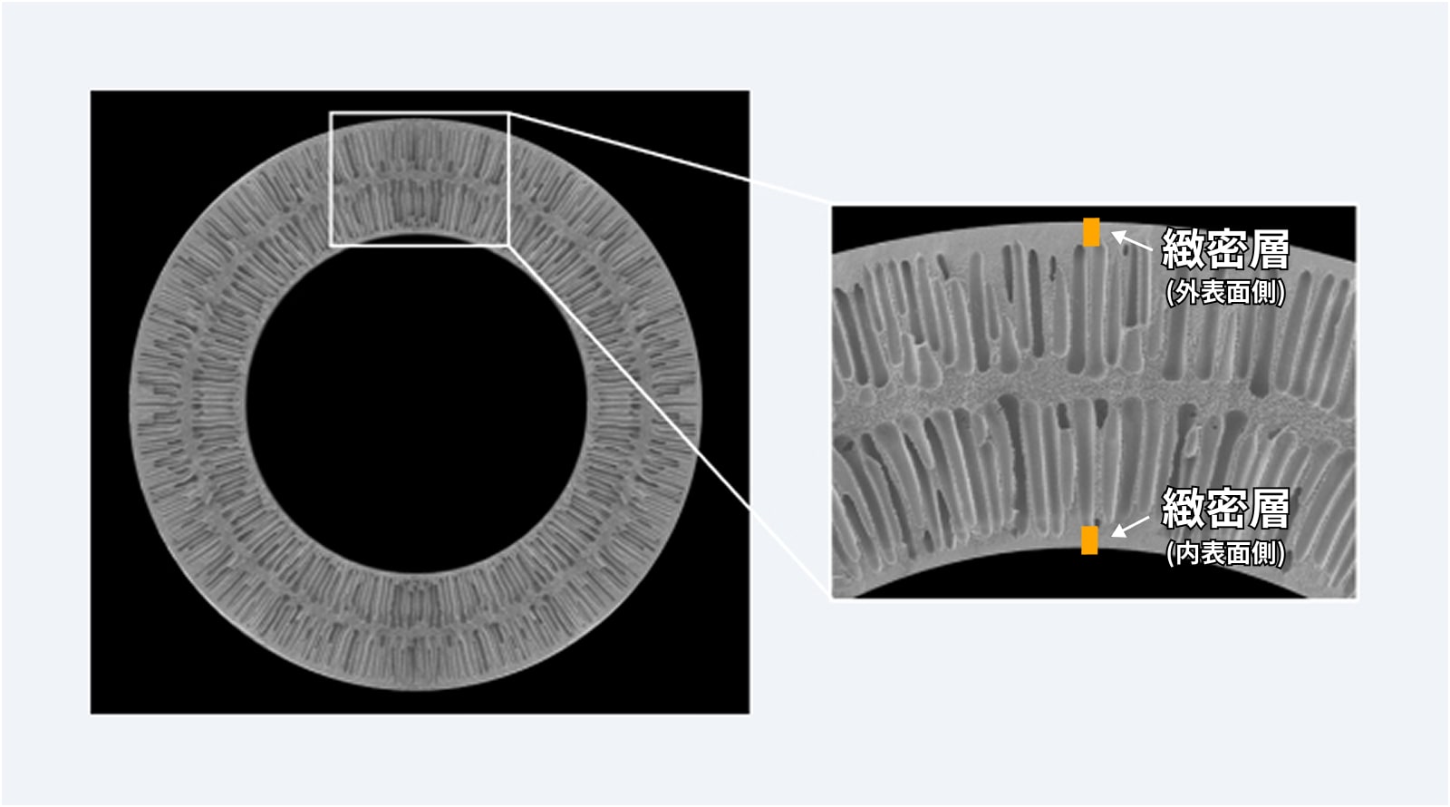 Electron Microscope Image of Microza® with Double-Layer Outer and Inner Structure