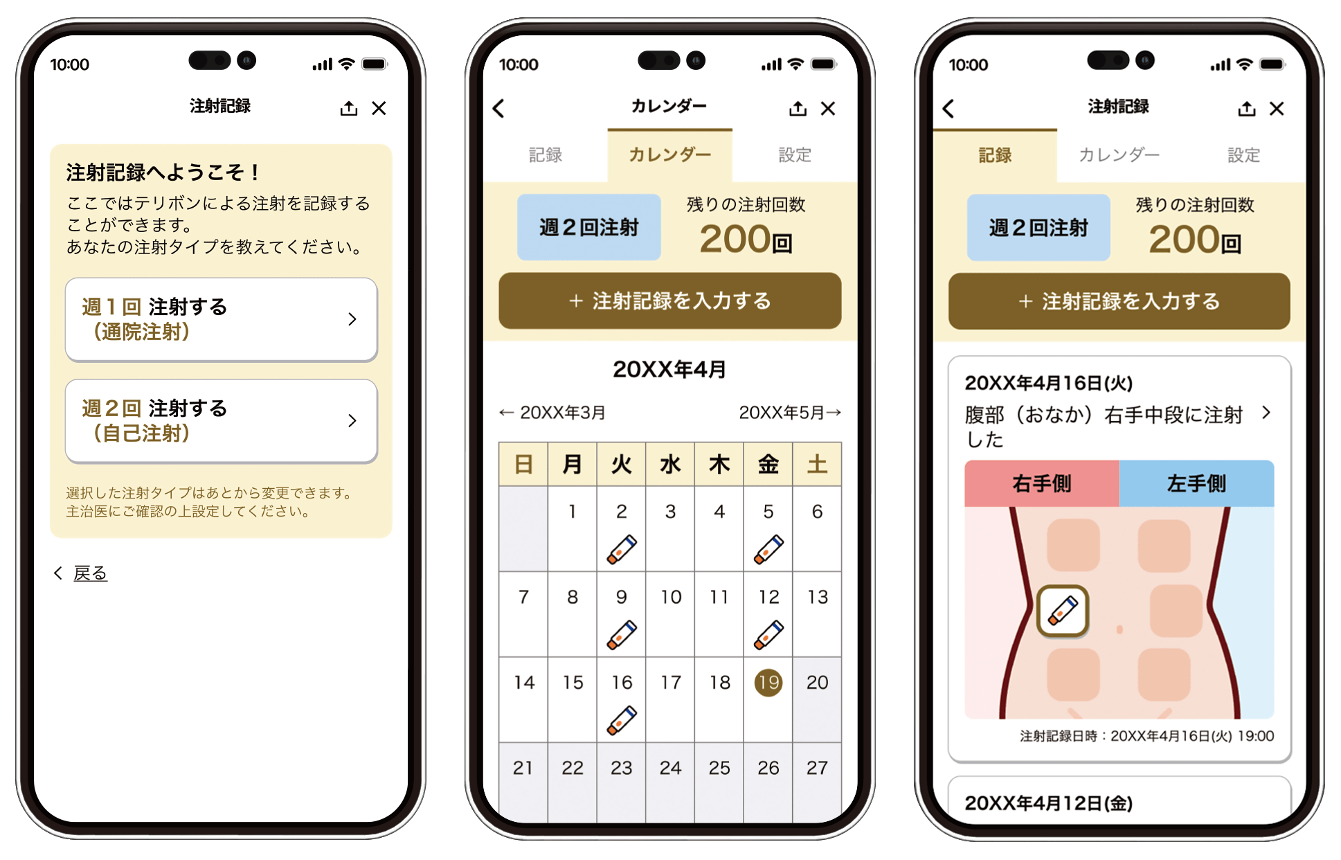 テリボンによる治療の流れ｜骨粗鬆症治療 Re-Bone.jp