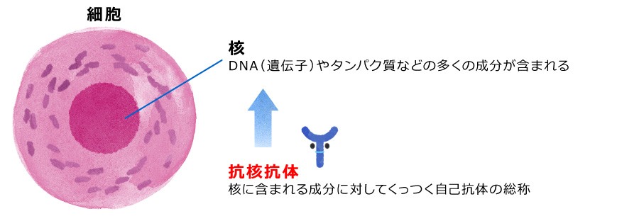 【抗核抗体とは】 