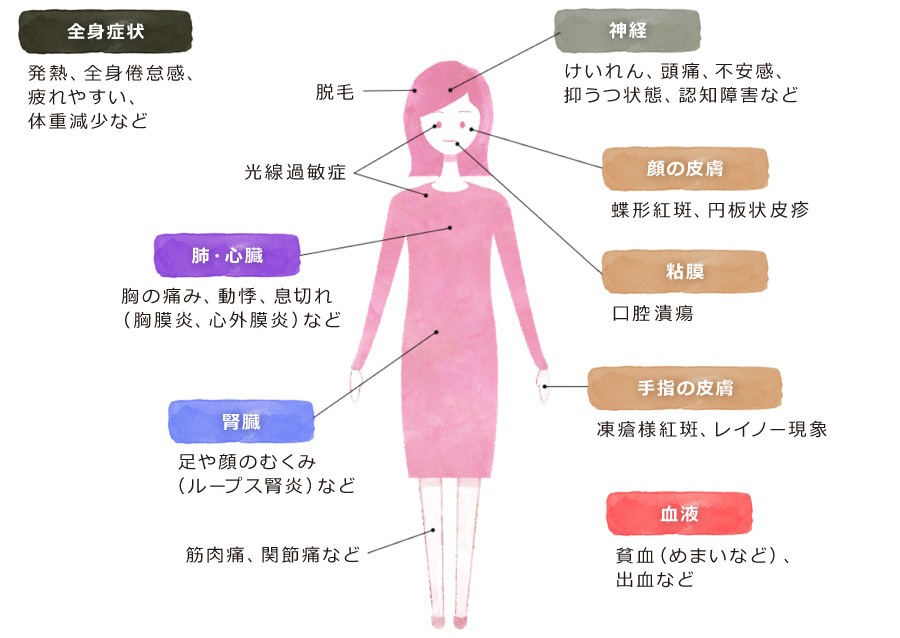 【SLEの主な症状】 