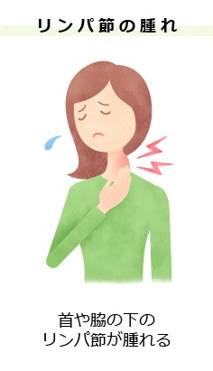 リンパ節の腫れ
