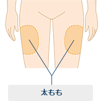 太もも