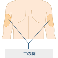 二の腕